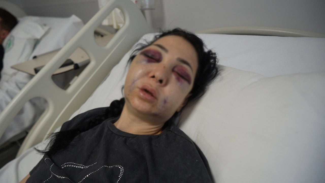 İzmitli Anne ve Oğlunu Darp Eden Gruptan Kürşat G. Tutuklandı