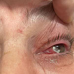 Kocaeli’de Kırlangıç Otu Faciası: Gözlükten Kurtulmak İsterken Kör Oluyordu!