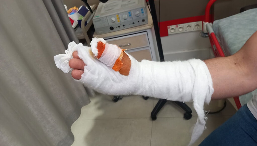 Basit Bir Kesik Kabusa Döndü! Nurettin Güleryüz’ün Ampute Edilen Parmağı İçin Suç Duyurusu