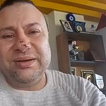 Onur Akay Pitbull Saldırısı Sonrası Açıklaması: "Ölümden Döndüm"