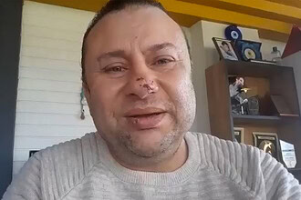 Onur Akay Pitbull Saldırısı Sonrası Açıklaması: "Ölümden Döndüm"