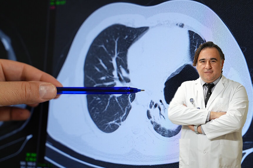 Mide Fıtığı Belirtileri Nelerdir? Dr. Uygar Düzci’den Kritik Uyarılar!