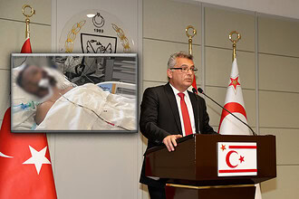 Kıbrıs'ta İnfial Yaratan Saldırı! Ayia Napa'da Kıbrıs Türk'ü Entübe Edildi: KKTC'den İlk Açıklama!