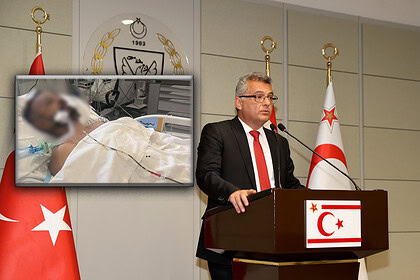 Kıbrıs'ta İnfial Yaratan Saldırı! Ayia Napa'da Kıbrıs Türk'ü Entübe Edildi: KKTC'den İlk Açıklama!
