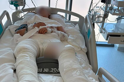 Otomobilin Çarptıktan Sonra Üzerinden Geçtiği Genç Kız Ağır Yaralandı! Darıca'daki Feci Kaza Anı Kamerada!
