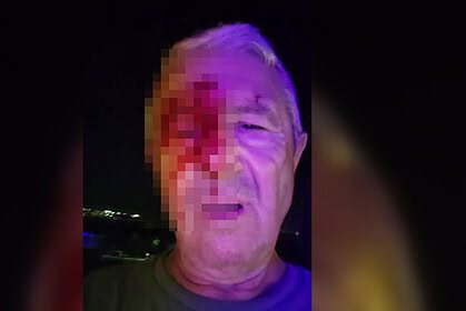 "Yüzüm Kanlar İçindeyken Kimse Yardım Etmedi!" Karamürsel'de Saldırıya Uğrayan Gazeteci O Anları Anlattı!