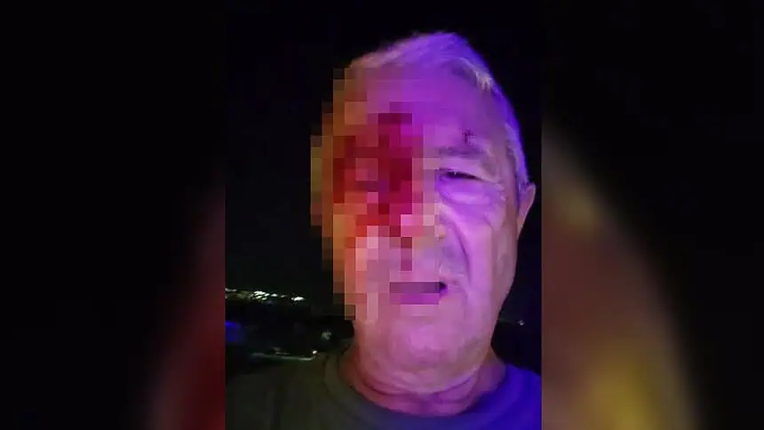 "Yüzüm Kanlar İçindeyken Kimse Yardım Etmedi!" Karamürsel'de Saldırıya Uğrayan Gazeteci O Anları Anlattı!