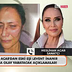 Neslihan Acar’dan Levent İnanır Hakkında Şiddet İddiası: 14 Yıl Sonra Gelen Fotoğraf!