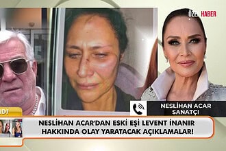 Neslihan Acar’dan Levent İnanır Hakkında Şiddet İddiası: 14 Yıl Sonra Gelen Fotoğraf!